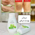 نمک بدن آلوئه ورا  اورجینال🪴 - تصویر 2